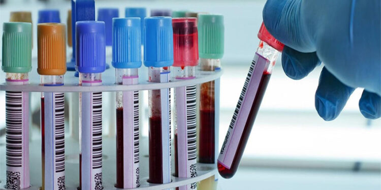 Los bioquímicos cortan prestaciones al IOSPER por falta de diálogo