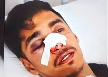Inseguridad en San Jaime de la Frontera, brutal ataque a un joven hipoacúsico