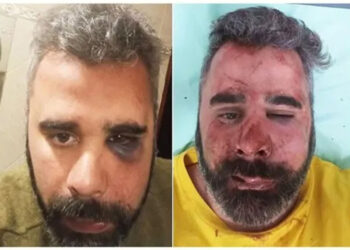 San José: golpearon al presidente del Partido Libertario