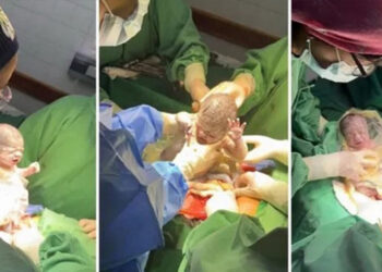 Nacieron en Salta trigemelas, un hecho poco frecuente