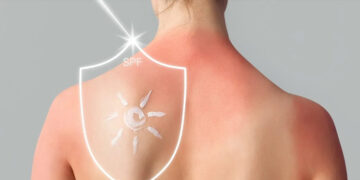 Llega el verano y aquí te ofrecemos recomendaciones para la exposición al sol