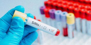 Entre Ríos registró 1.029 casos de sífilis en 2025